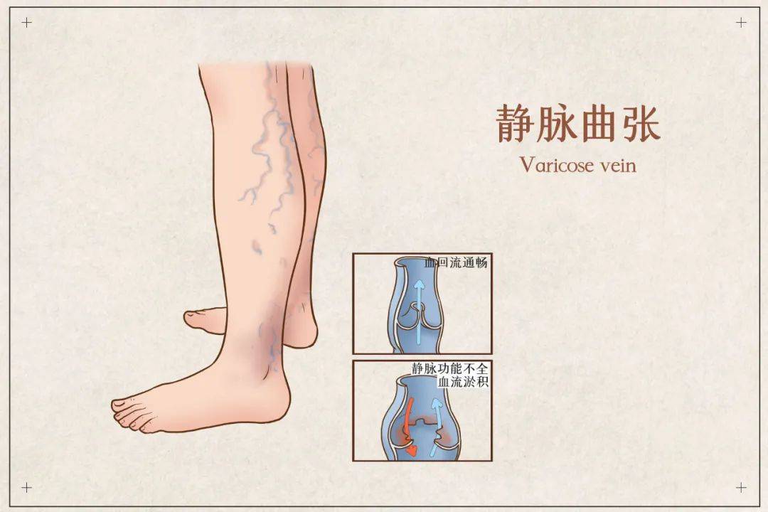 職業病中標率100%！廚師的傷痛有誰知？